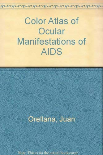 Beispielbild fr Color Atlas of Ocular Manifestations of AIDS: Diagnosis and Management zum Verkauf von HPB-Red