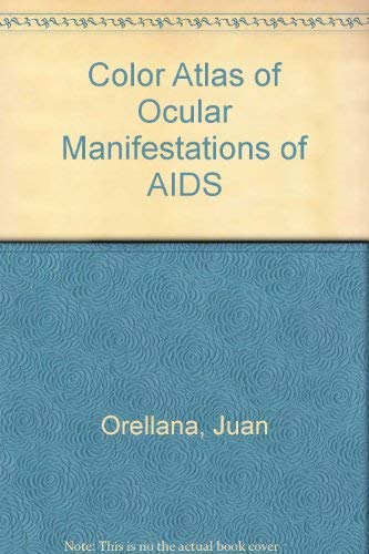 Stock image for Color Atlas of Ocular Manifestations of AIDS: Diagnosis and Management for sale by HPB-Red