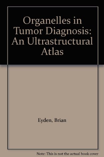 Organelles in Tumor Diagnosis: An Ultrastructural Atlas (9780896403116) by Eyden, Brian