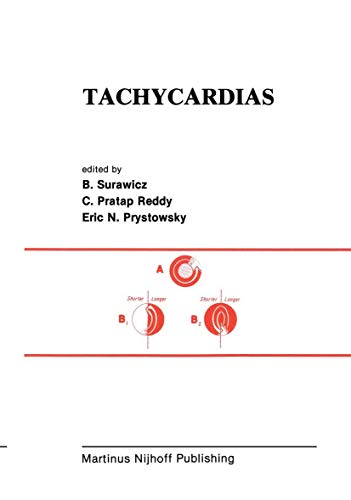 9780898385885: Tachycardias (Developments in Cardiovascular Medicine, 28)