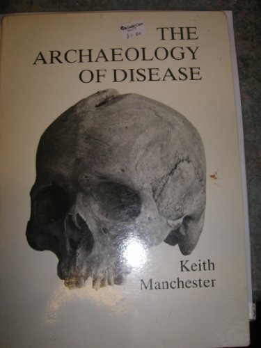9780901945518: The archaeology of disease