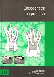Stock image for Endodontics in Practice for sale by AwesomeBooks