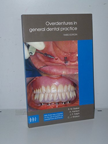 Stock image for Overdentures in GDP for sale by WorldofBooks