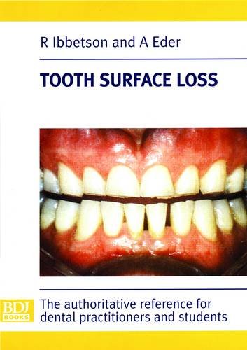 9780904588668: Tooth Surface Loss
