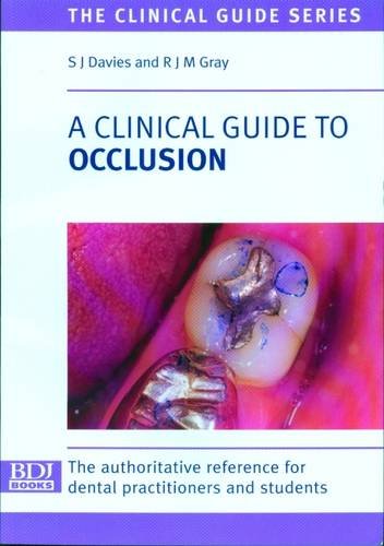 Beispielbild fr A Clinical Guide to Occlusion (Clinical Guide S.) zum Verkauf von WorldofBooks