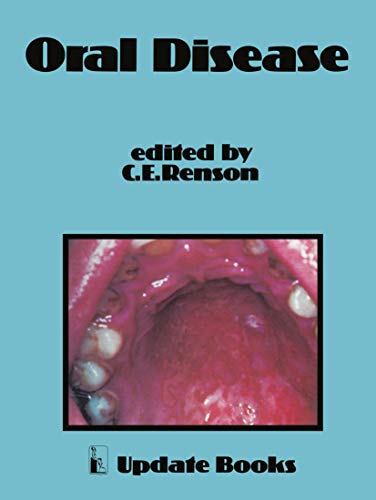 Beispielbild fr Oral Disease zum Verkauf von WorldofBooks