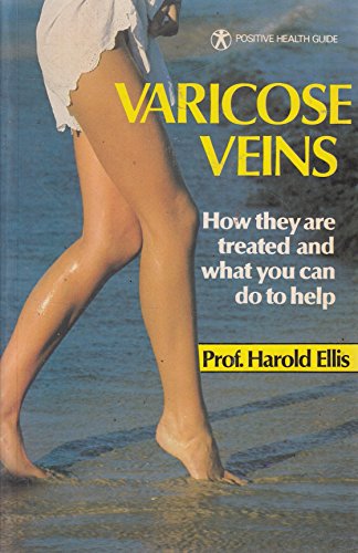 Imagen de archivo de Varicose Veins: How They Are Treated and What You Can Do to Help (Positive Health Guide) a la venta por Goldstone Books