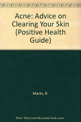 9780906348536: Acne: Advice on Clearing Your Skin