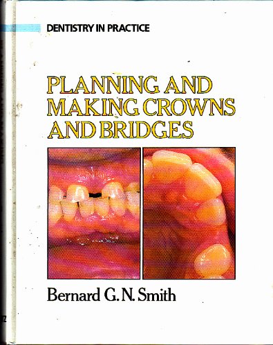 Beispielbild fr Planning and Making Crowns and Bridges (Dentistry in practice) zum Verkauf von medimops