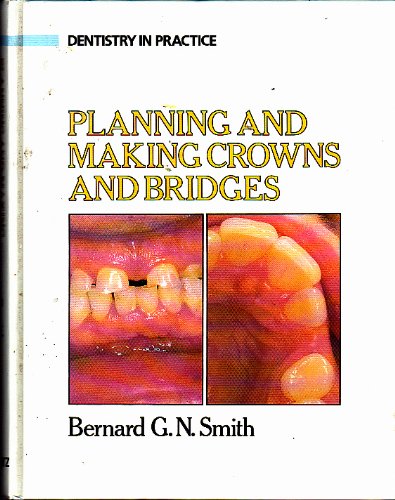 Imagen de archivo de Planning and Making Crowns and Bridges (Dentistry in practice) a la venta por medimops