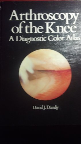 9780906923214: Arthroscopy of the knee: A diagnostic colour atlas