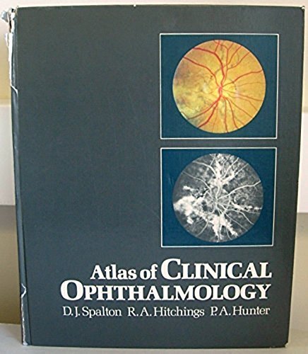 9780906923238: Atlas of clinical ophthalmology