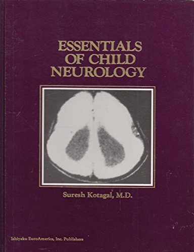 Imagen de archivo de Essentials of Child Neurology a la venta por Hay-on-Wye Booksellers