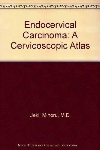 Beispielbild fr Endocervical Carcinoma: A Cervicoscopic Atlas zum Verkauf von P.C. Schmidt, Bookseller