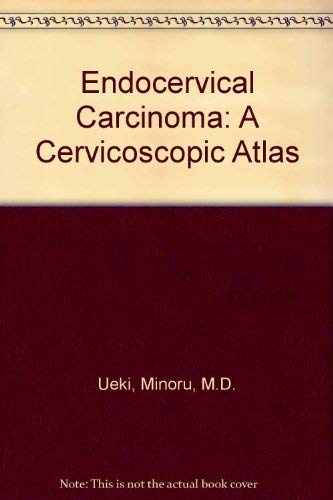 Stock image for Endocervical Carcinoma: A Cervicoscopic Atlas for sale by P.C. Schmidt, Bookseller