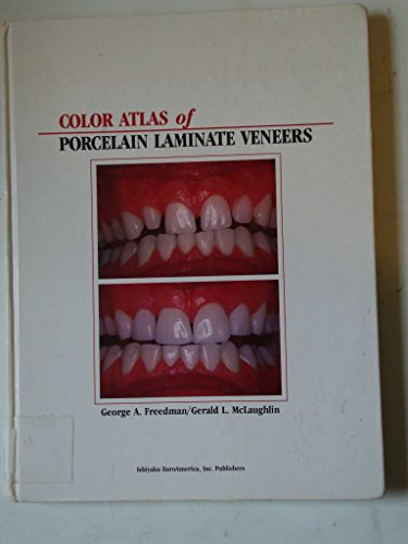 Beispielbild fr Color Atlas of Porcelain Laminate Veneers zum Verkauf von Zubal-Books, Since 1961