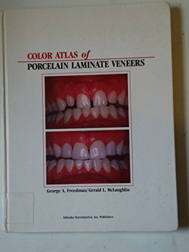 9780912791524: Colour Atlas of Porcelain Laminate Veneers