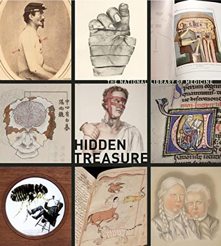 Stock image for Hidden Treasure: The National Library of Medicine for sale by SecondSale