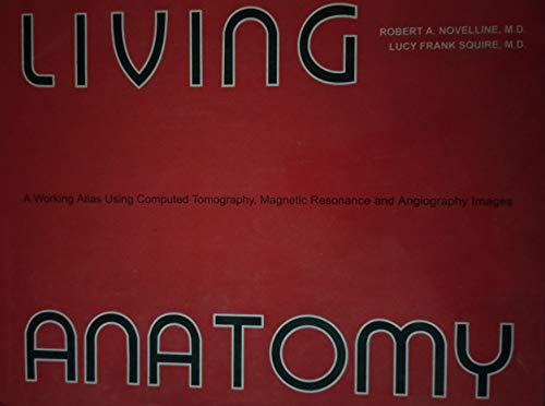 9780932883032: Living Anatomy: A Working Atlas Using Computed Tomography, Magnetic Resonance & Angiography Images