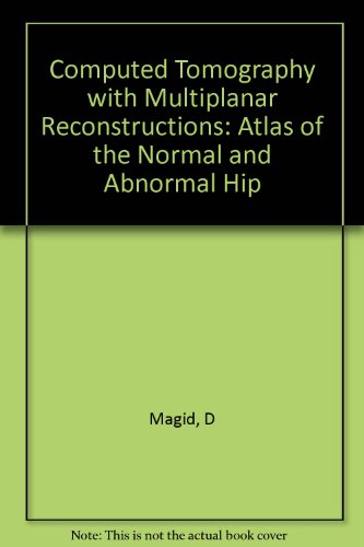 9780938607090: Computed Tomography With Multiplanar Reconstructions: An Atlas of the Normal and Abnormal Hip