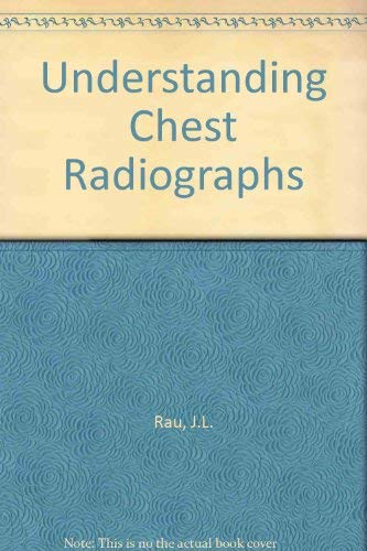 Stock image for Understanding Chest Radiographs for sale by Village Books and Music