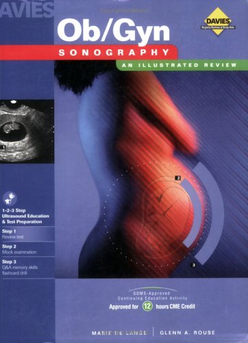 Beispielbild fr Ob/Gyn Sonography: An Illustrated Review zum Verkauf von Red's Corner LLC