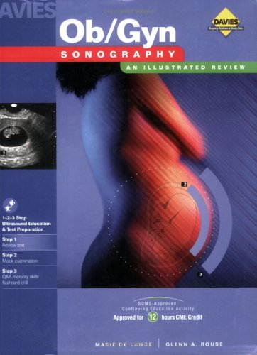 Stock image for Ob/Gyn Sonography: An Illustrated Review for sale by Feather books