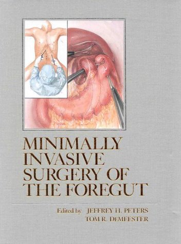 Beispielbild fr Minimally Invasive Surgery Of The Foregut. zum Verkauf von CSG Onlinebuch GMBH