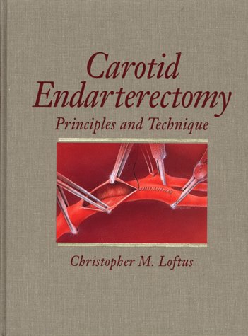 Beispielbild fr Carotid Endarterectomy zum Verkauf von Books Puddle