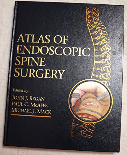 Atlas of Endoscopic Spine Surgery