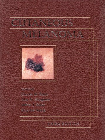 Beispielbild fr Cutaneous Melanoma zum Verkauf von Ammareal