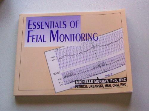 Imagen de archivo de Essentials of Fetal Monitoring a la venta por Readers Cove Used Books & Gallery