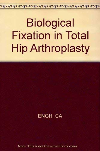 Imagen de archivo de Biological Fixation in Total Hip Arthroplasty a la venta por ThriftBooks-Dallas