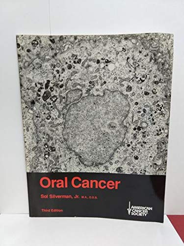 Oral cancer (9780944235058) by Sol Silverman Jr.; American Cancer Society