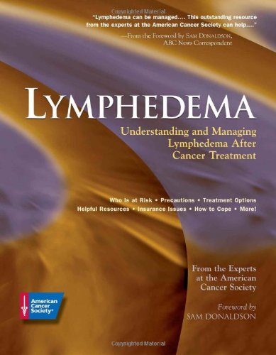 Lymphedema: Understanding and Managing Lymphedema After Cancer Treatment (9780944235560) by American Cancer Society