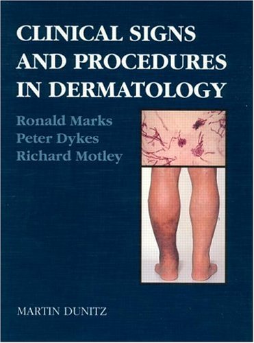 Stock image for Clinical Signs and Procedures in Dermatology for sale by AwesomeBooks