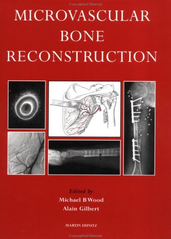 Beispielbild fr Microvascular Bone Reconstruction zum Verkauf von Anybook.com