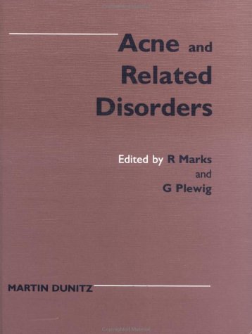 Acne and Related Disorders (9780948269943) by Marks, Ronald; Plewig, Gerd