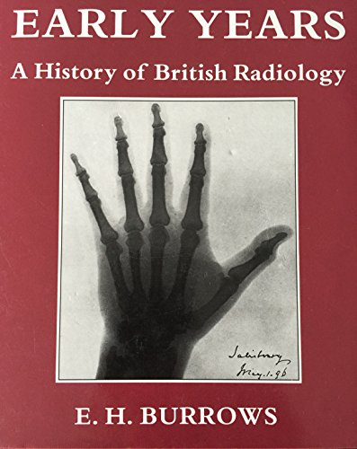 Pioneers and Early Years: History of British Radiology