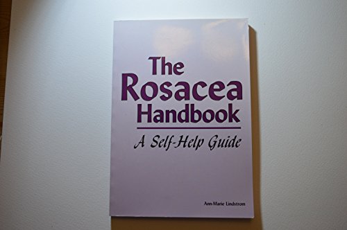 Beispielbild fr The Rosacea Handbook: A Self-Help Guide zum Verkauf von Goldstone Books