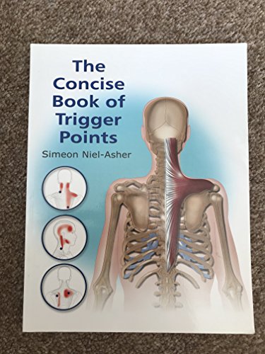 Stock image for Concise Book of Trigger Points for sale by Better World Books Ltd