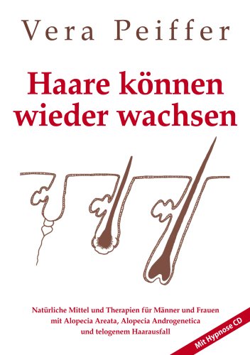 9780954722739: Haare Konnen Wieder Wachsen (German Edition)