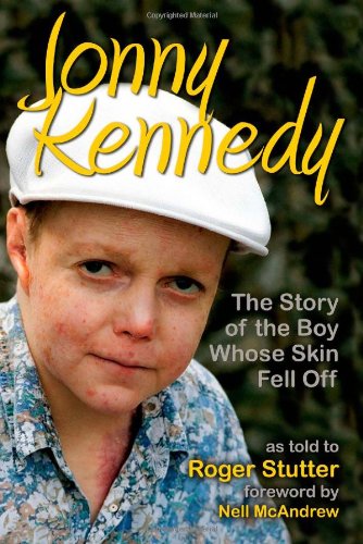 Imagen de archivo de Jonny Kennedy: The Story of the Boy Whose Skin Fell Off a la venta por WorldofBooks