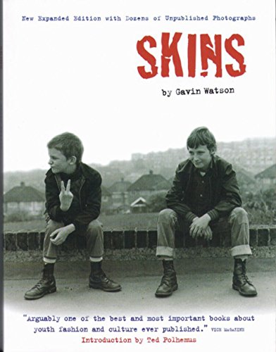 Skins - Gavin Watson