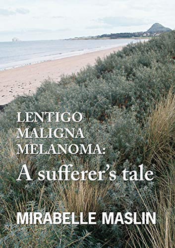 Stock image for Lentigo Maligna Melanoma A Sufferer's Tale for sale by PBShop.store US