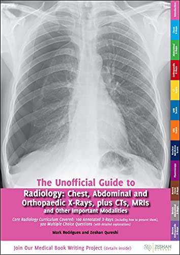 Stock image for Unofficial Guide to Radiology: Chest, Abdominal and Orthopaedic X Rays, Plus CTs, MRIs and Other Important Modalities: Core Radiology Curriculum (Unofficial Guides) for sale by BooksRun