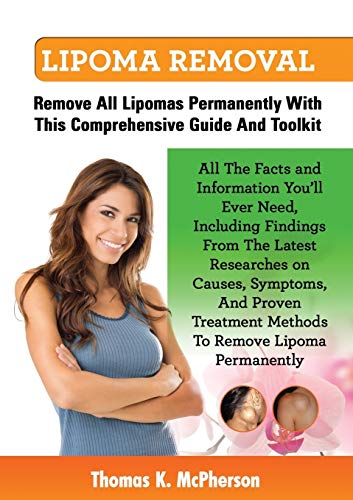 Stock image for Lipoma Removal, Lipoma Removal Guide. Discover All the Facts and Information on Lipoma, Fatty Lumps, Painful Lipoma, Facial Lipoma, Breast Lipoma, Can for sale by ThriftBooks-Dallas