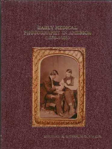 Early Medical Photography In America, 1839-1883 (9780961295806) by Stanley B. Burns