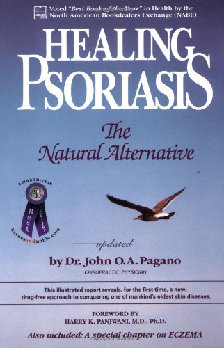 Beispielbild fr Healing Psoriasis: The Natural Alternative zum Verkauf von Wonder Book