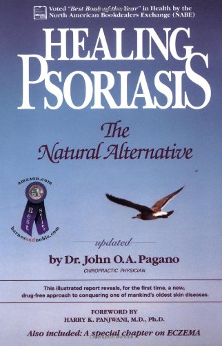 9780962884702: Healing Psoriasis: The Natural Alternative